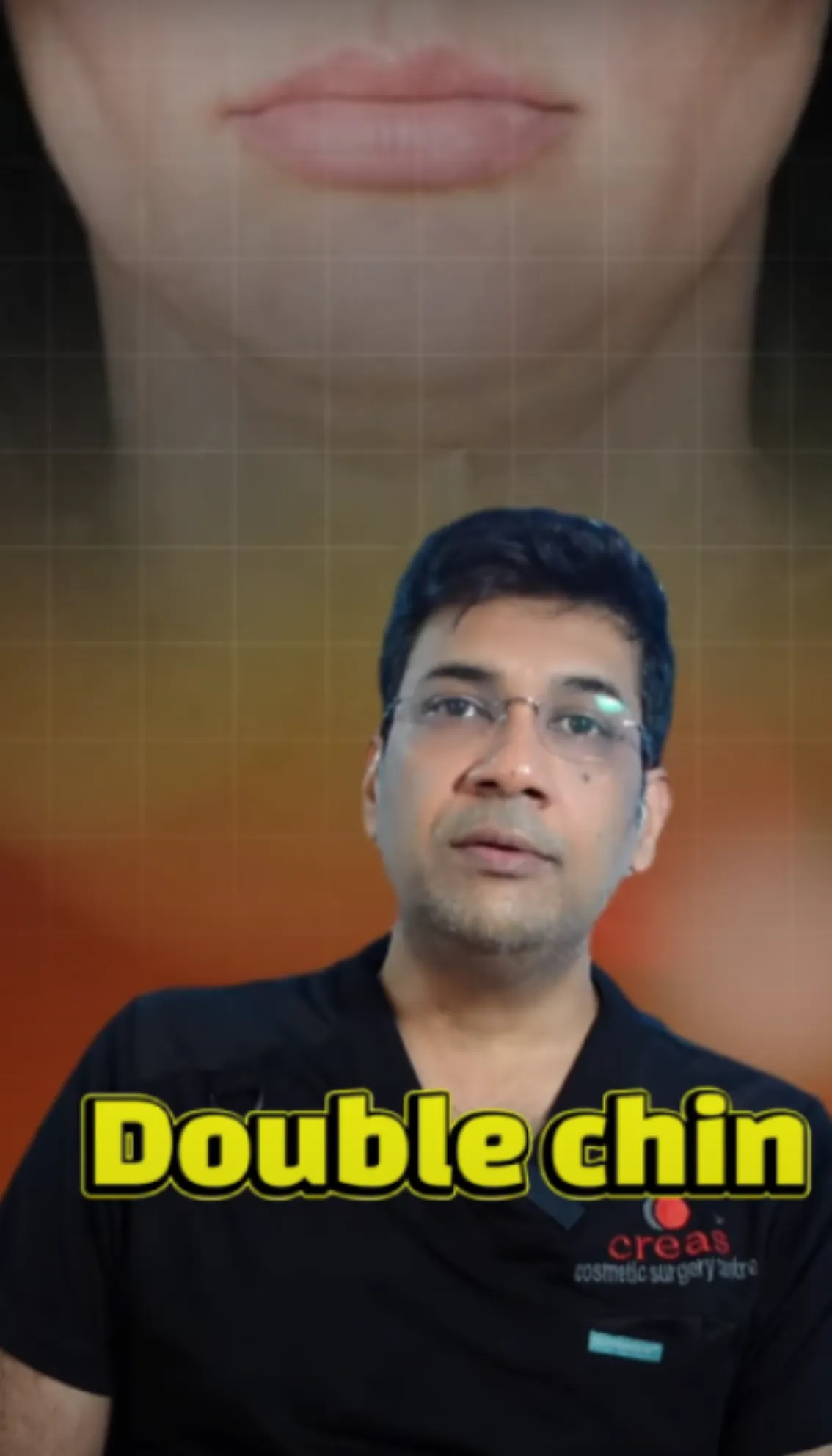 Double Chin Problem