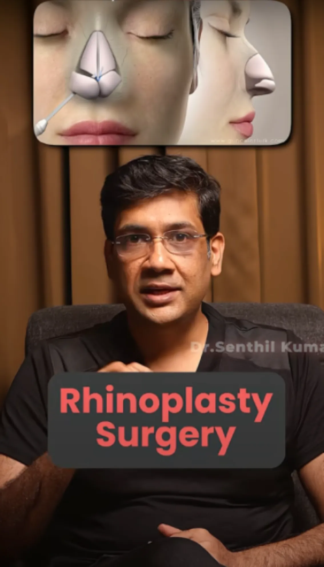 Rhinoplasty Surgery