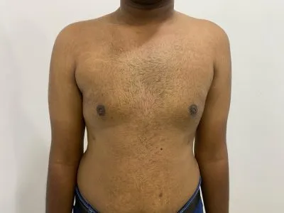 After Image