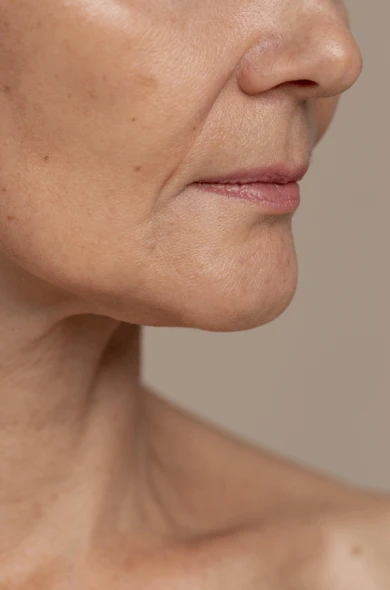 Non-Surgical Age Reversal Treatment